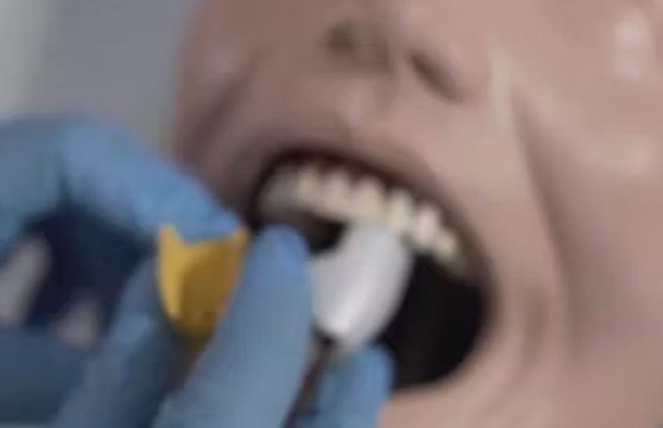 Rehabilitación oral protésica, operatorias dentales y exodoncias en la población de atención prioritaria de la Zona 6
